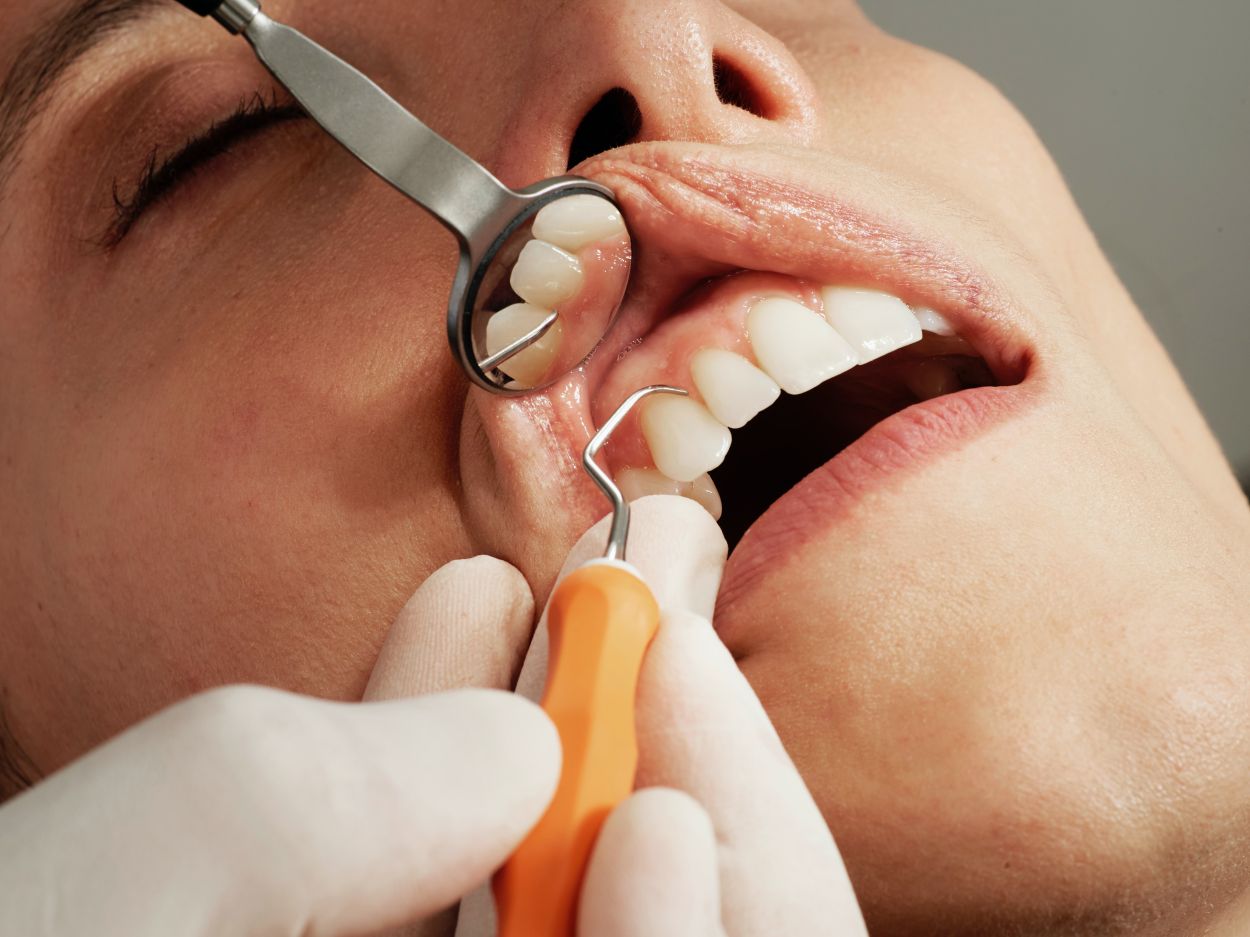 ​Fighting Hereditary Dental Problems