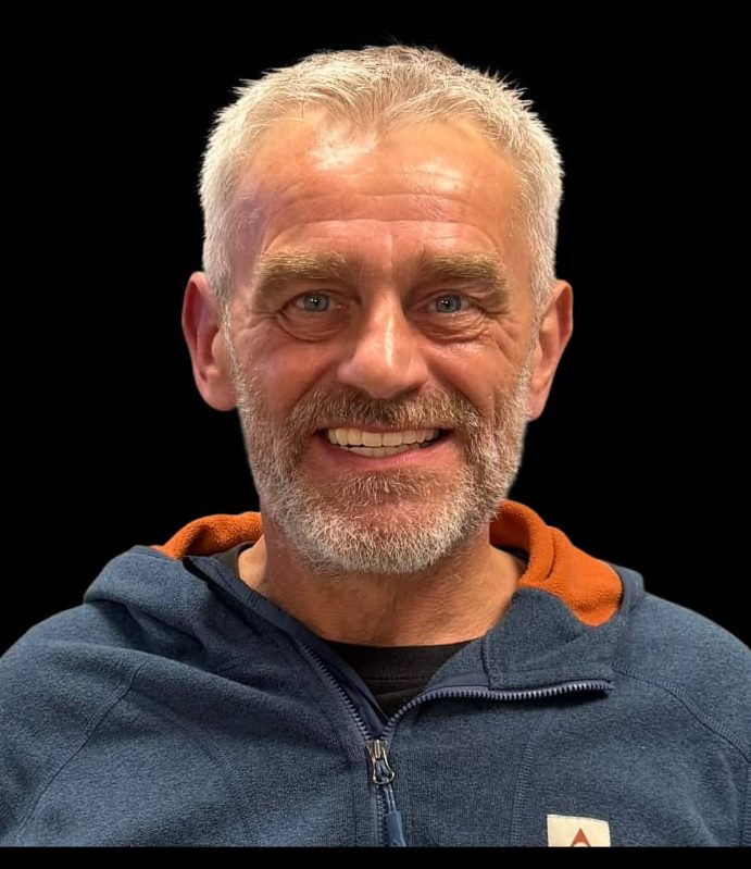 The same patient smiling after Same Day Teeth treatment